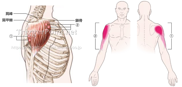 三角筋 肩部 好発部位について Trigger Point Net トリガーポイント ネット 医療関係者向け情報