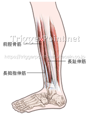 前脛骨筋 下肢 好発部位について Trigger Point Net トリガーポイント ネット 医療関係者向け情報