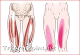大腿四頭筋群（大腿直筋、外側広筋、内側広筋、中間広筋）