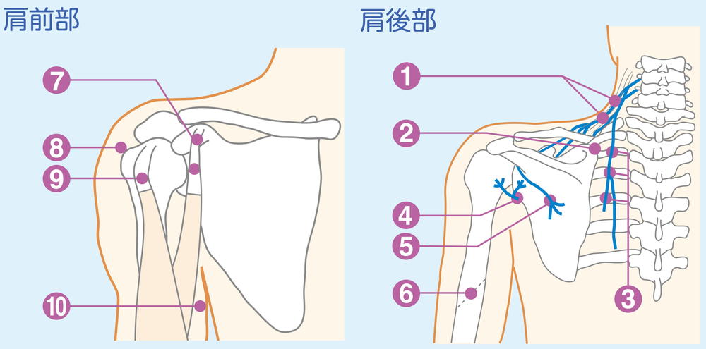 部位別トリガーポイント 肩の痛み Trigger Point Net トリガーポイント ネット
